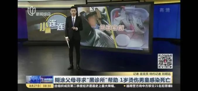 1岁娃烫伤后死亡 全怪爸妈做了这个决定 娃烫伤后有个雷区千万别碰 腾讯新闻