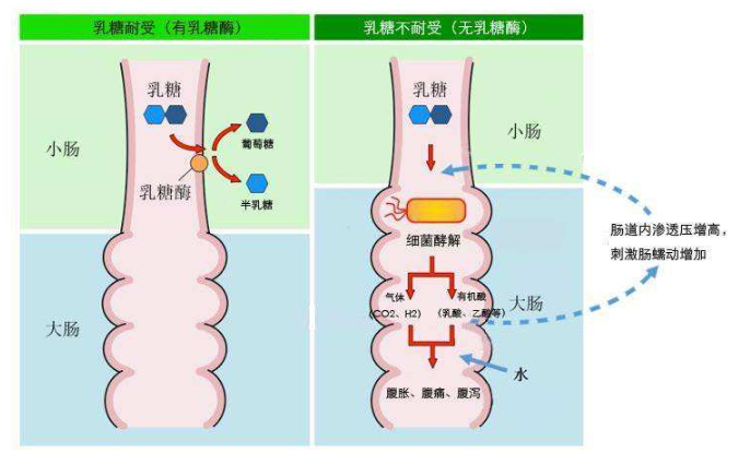 乳糖不耐受是一种怎样的体验 腾讯新闻