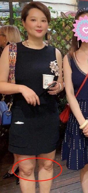 袁立|47岁袁立近照，身材臃肿气质佳，膝盖皮肤松垮严重暴露老态