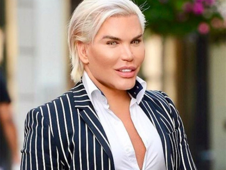 巴西整容男芭比海边晒性感小腰为变性又整75次下一步想生娃