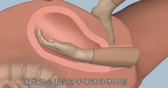 这四个是顺产时最痛的点,希望你不用经历_腾讯新闻