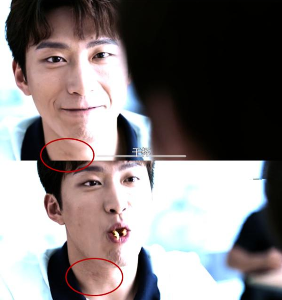 窦骁颈部草莓印记引热议何超莲正式辟谣是伤疤