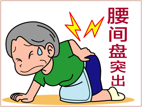 腰椎间盘突出症|腰椎间盘突出有哪些症状呢