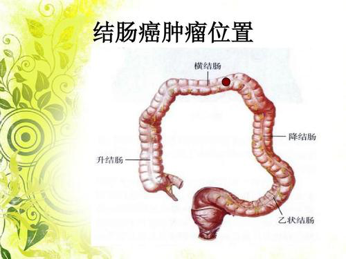 结肠是人体消化系统的一部分,由近至远依次分为盲肠,升结肠,结肠肝曲