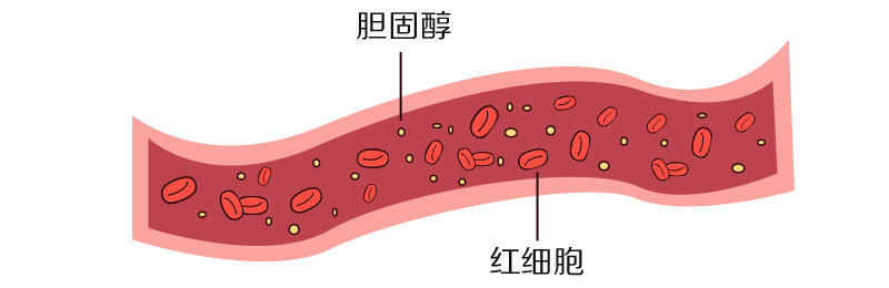 高血脂|3个饮食方法让你远离高血脂！