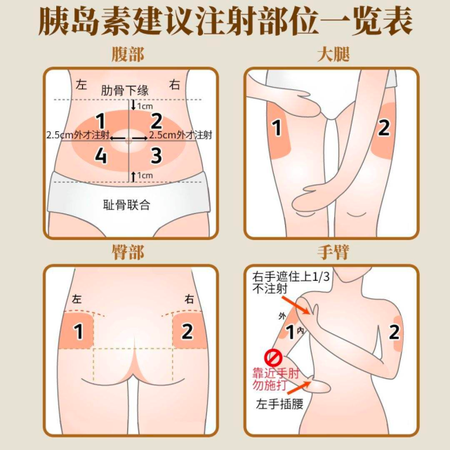得了1型糖尿病就要不久人世了