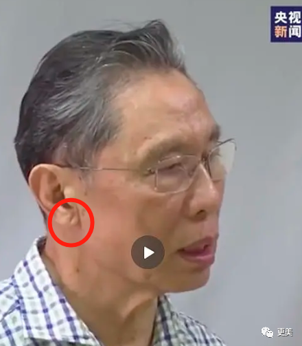 王俊凯|钱枫胖到快要发病？王俊凯竟也有同款病兆…