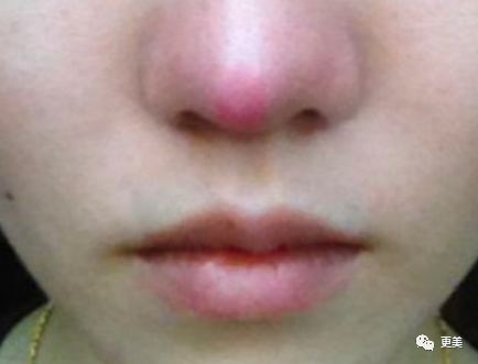 王俊凯|钱枫胖到快要发病？王俊凯竟也有同款病兆…