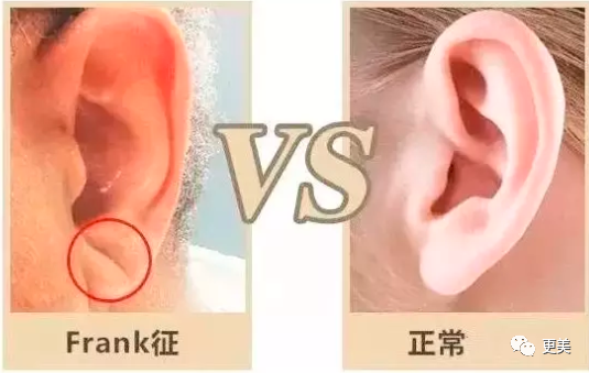 王俊凯|钱枫胖到快要发病？王俊凯竟也有同款病兆…