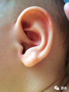 王俊凯|钱枫胖到快要发病？王俊凯竟也有同款病兆…