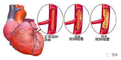 王俊凯|钱枫胖到快要发病？王俊凯竟也有同款病兆…