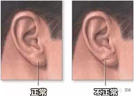 王俊凯|钱枫胖到快要发病？王俊凯竟也有同款病兆…