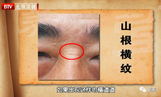 王俊凯|钱枫胖到快要发病？王俊凯竟也有同款病兆…