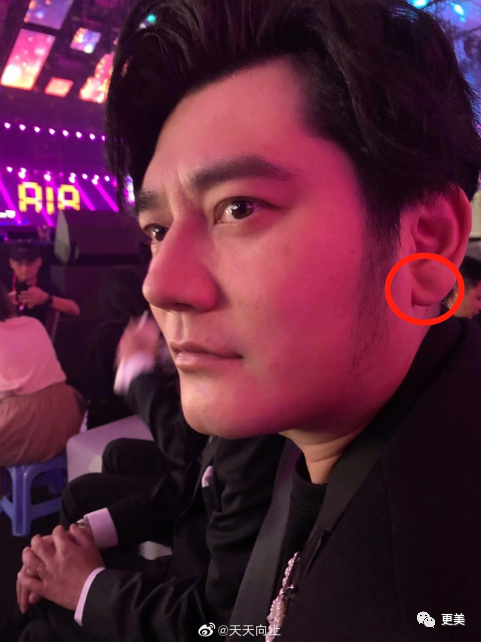 王俊凯|钱枫胖到快要发病？王俊凯竟也有同款病兆…