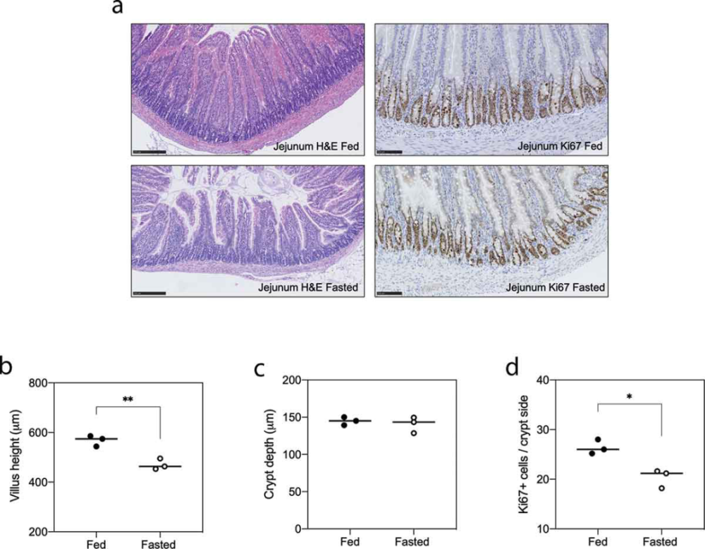 癌症化疗所致肠道损伤怎么破或可通过禁食改善肠道细菌