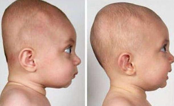 满族|现代中国人的扁头是如何形成的？是满族带进来的吗？那古代可有？