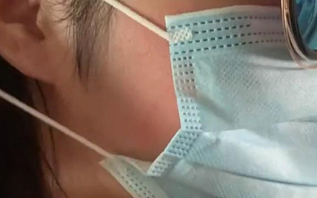 猫咪|妹子脸上长了脚气，去医院也是一头问号：都是养猫惹出的问题啊