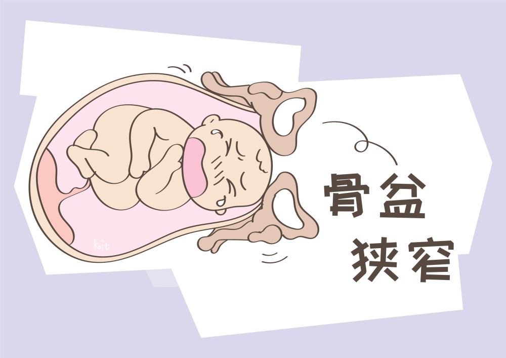 欧美人的骨盆相对宽大,这对于生产时非常有利的,而亚洲妈妈的骨盆较为