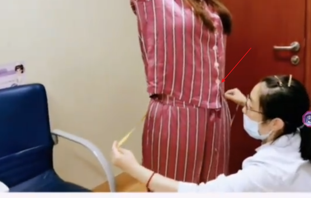 杨天真|杨天真切胃手术一个月后复诊，大肚变瘪瘦好多，网友：感觉变样了