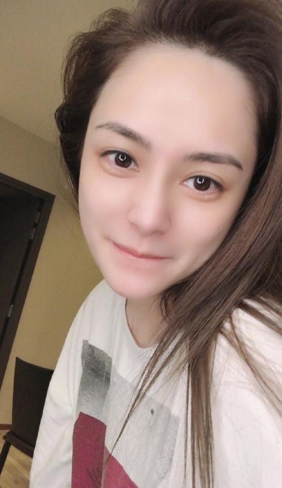 钟欣潼|阿娇伤后四天即复工，杀青照中用手遮挡伤口，笑容灿烂状态好