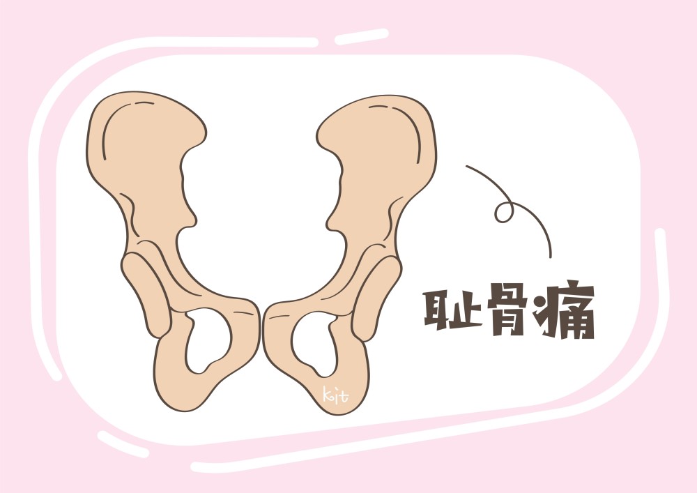 怀孕期间,这5类女性要注意,"耻骨痛"更容易"盯"上你_腾讯新闻