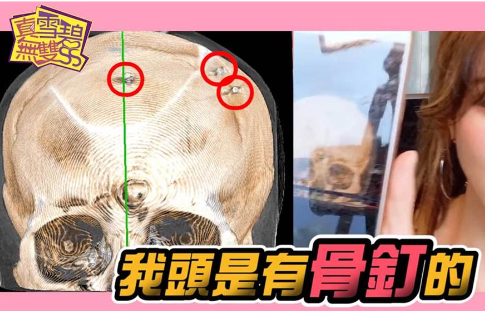 网红|台湾女艺人砸400万整形15次，手术照曝光让人害怕