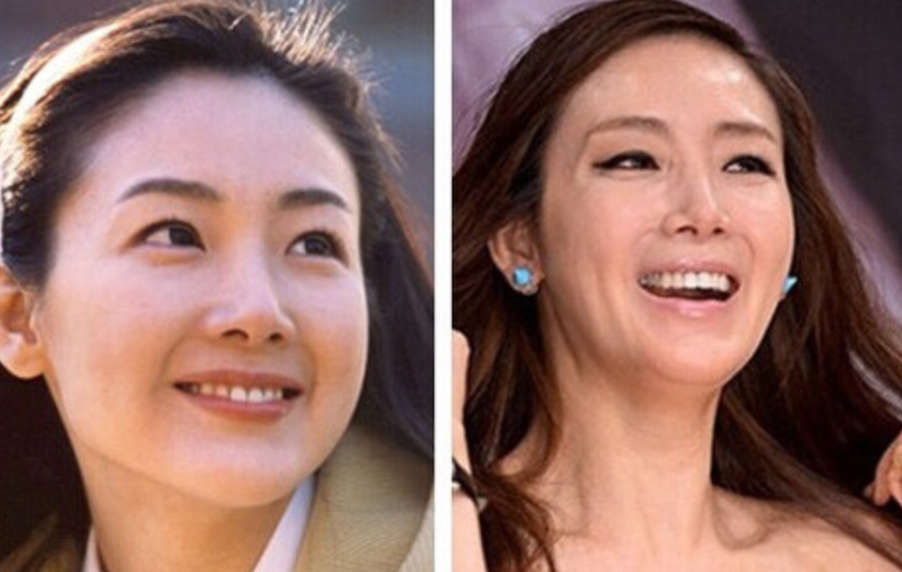 网红|台湾女艺人砸400万整形15次，手术照曝光让人害怕