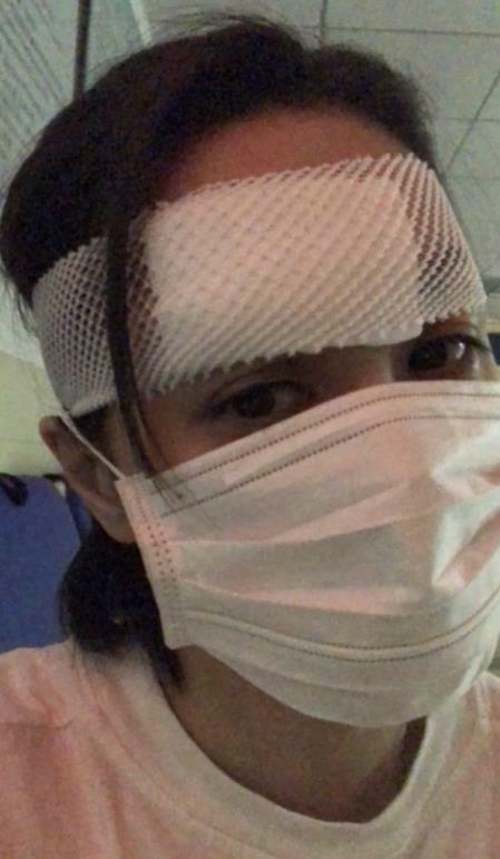 钟欣潼|阿娇拆绷带后首露面，拿手遮住伤口，网友：不会留疤了吧？