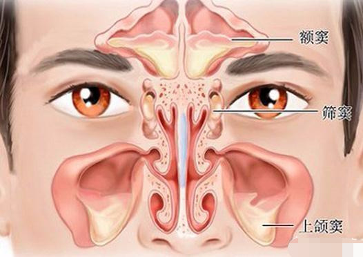 如何治疗慢性蝶窦炎 腾讯新闻