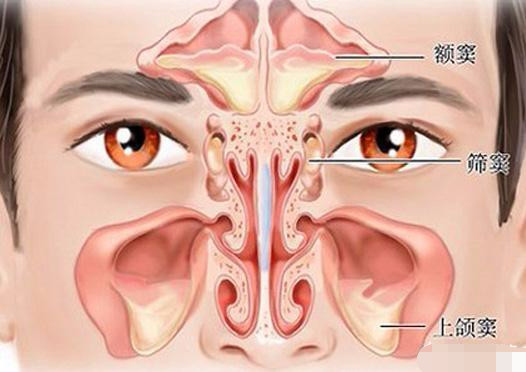 如何治疗慢性蝶窦炎