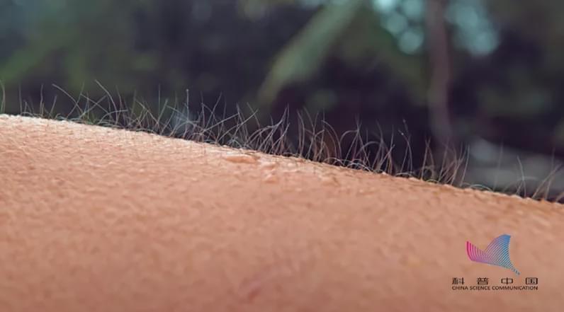 立毛肌|感觉冷时为什么会起“鸡皮疙瘩”？