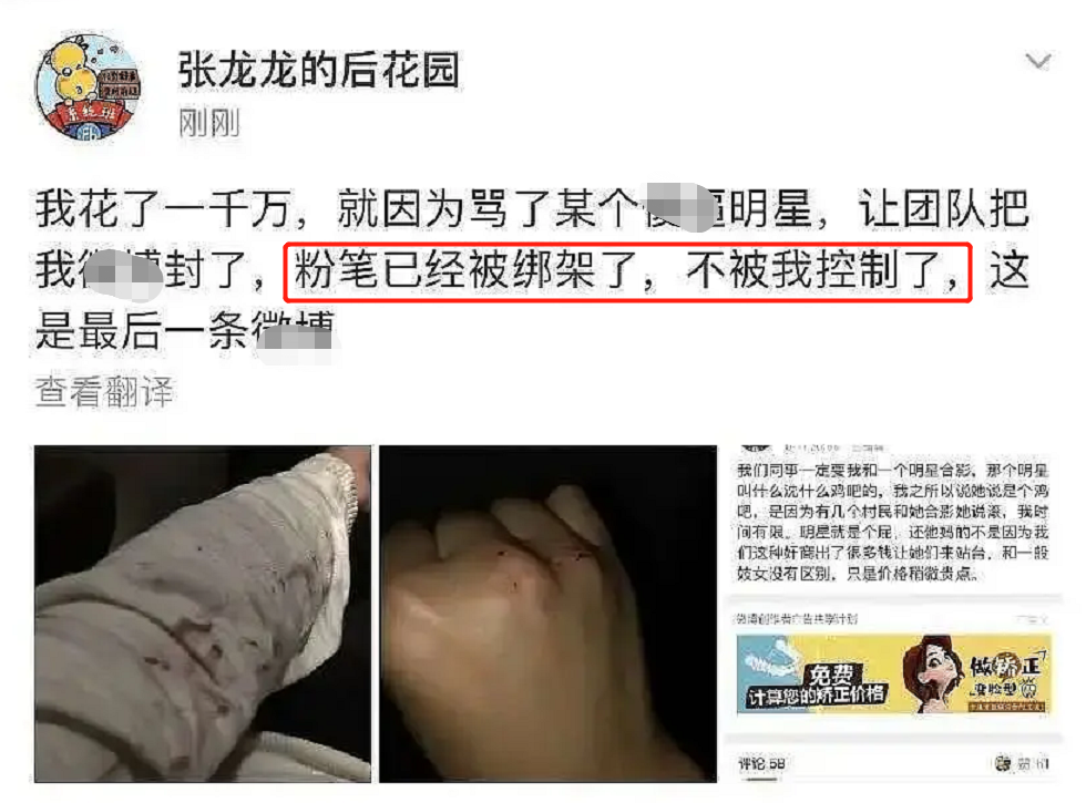 张小龙|粉笔张小龙骂沈梦辰后疑权利被架空，晒受伤流血照称公司被绑架