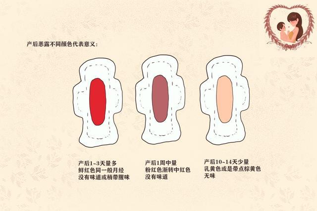 产后排恶露要经历三个阶段观察状态和护理要点宝妈要清楚