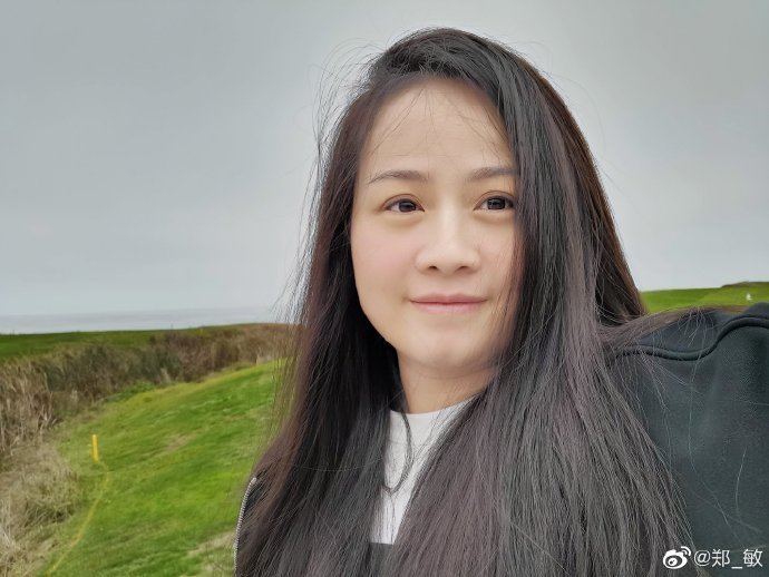 岳云鹏|岳云鹏老婆术后首晒照，头发长出身体消瘦，曾因生病剃光头