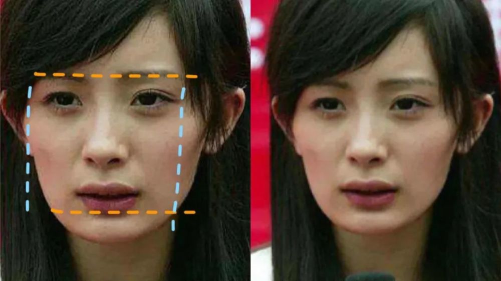 整容|3分到8分，为什么有人是天生适合整容脸？