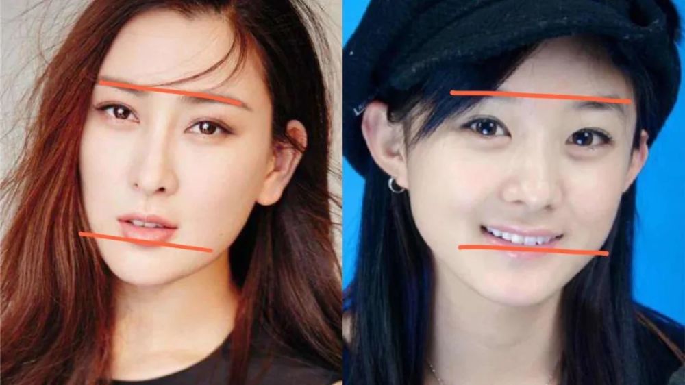 整容|3分到8分，为什么有人是天生适合整容脸？
