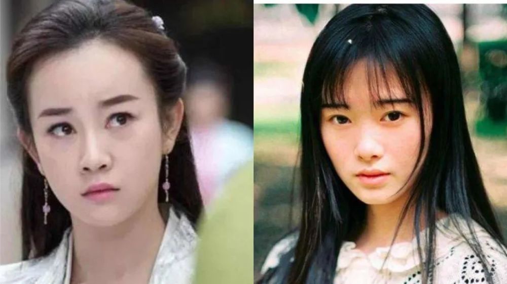 整容|3分到8分，为什么有人是天生适合整容脸？