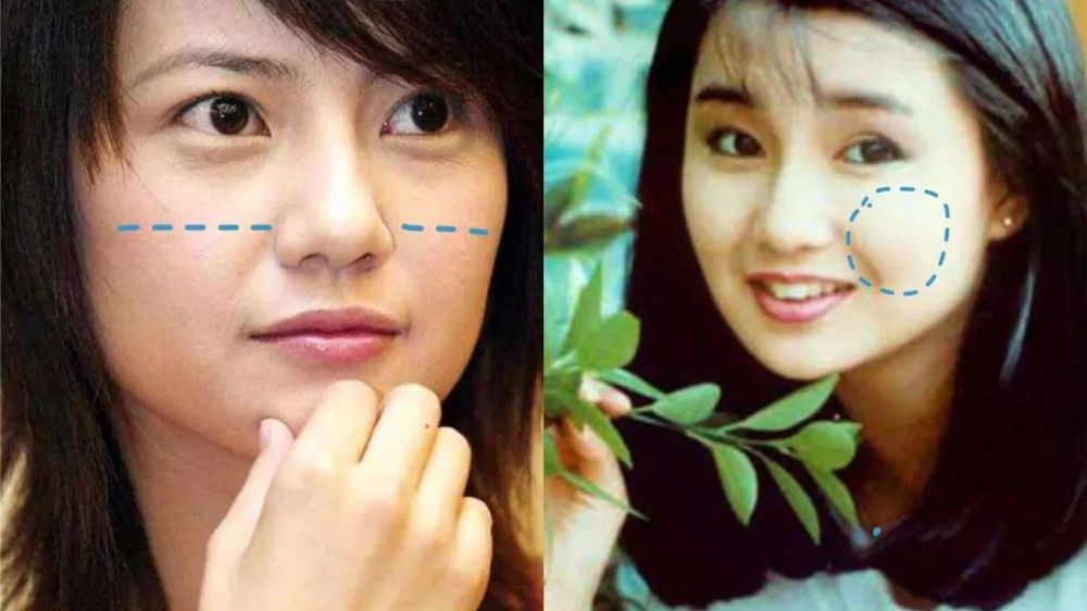 整容|3分到8分，为什么有人是天生适合整容脸？