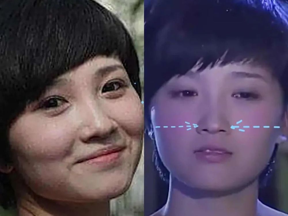整容|3分到8分，为什么有人是天生适合整容脸？