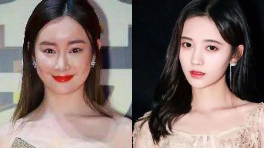 整容|3分到8分，为什么有人是天生适合整容脸？