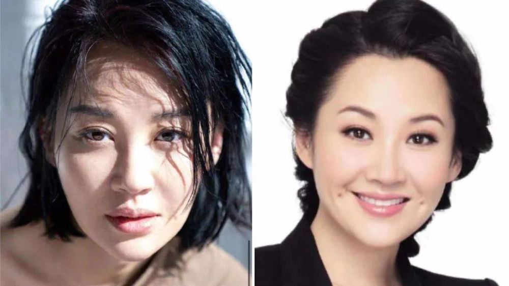 整容|3分到8分，为什么有人是天生适合整容脸？