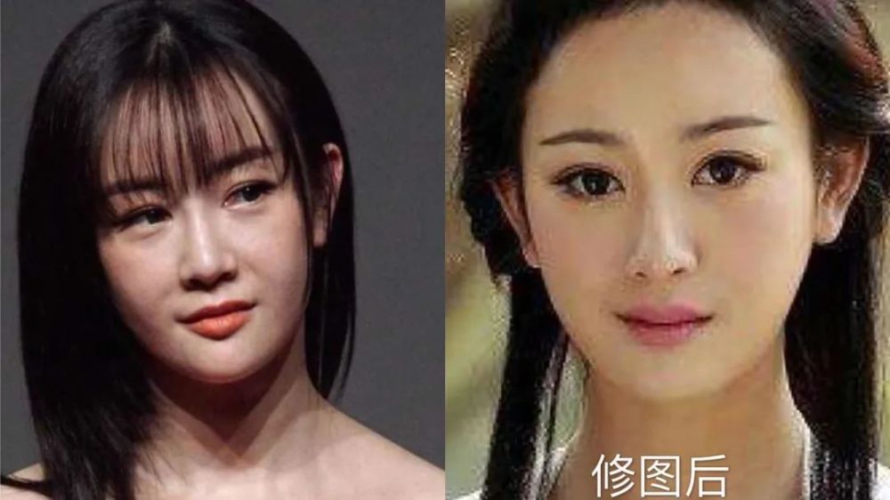 整容|3分到8分，为什么有人是天生适合整容脸？