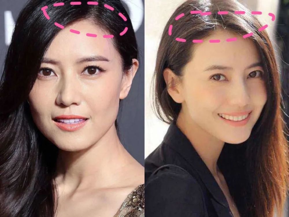 整容|3分到8分，为什么有人是天生适合整容脸？