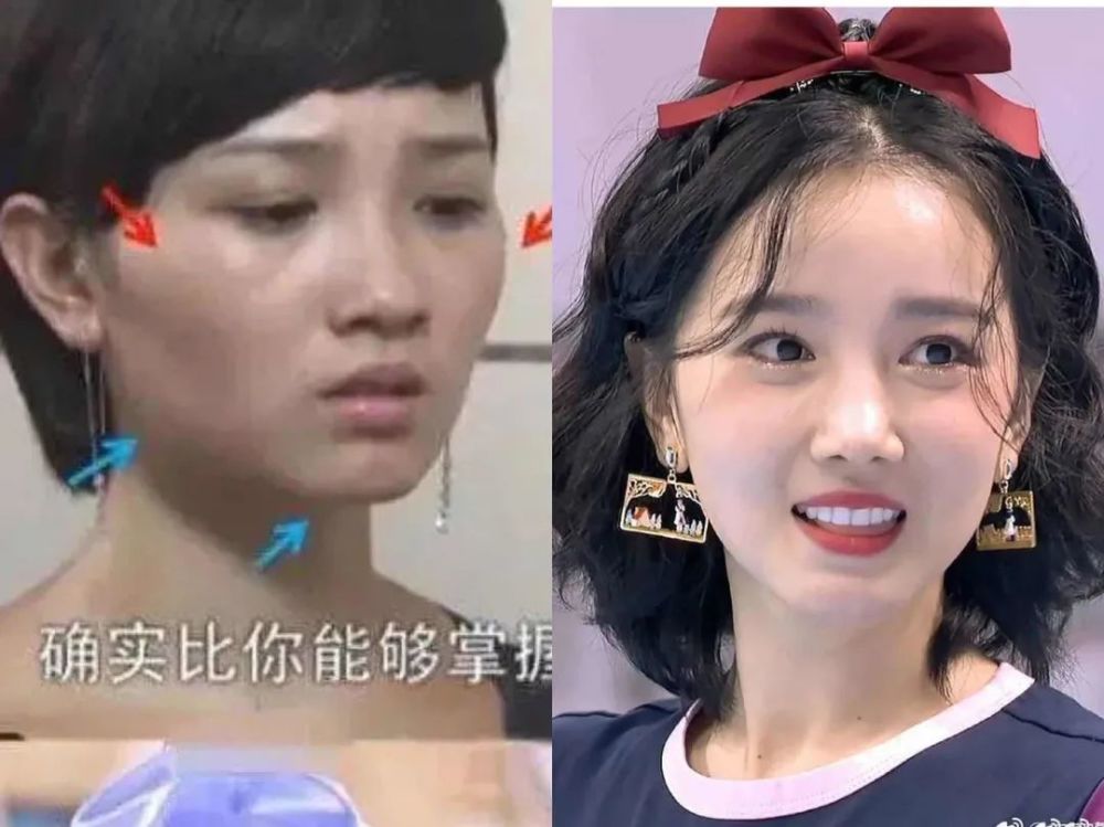 整容|3分到8分，为什么有人是天生适合整容脸？