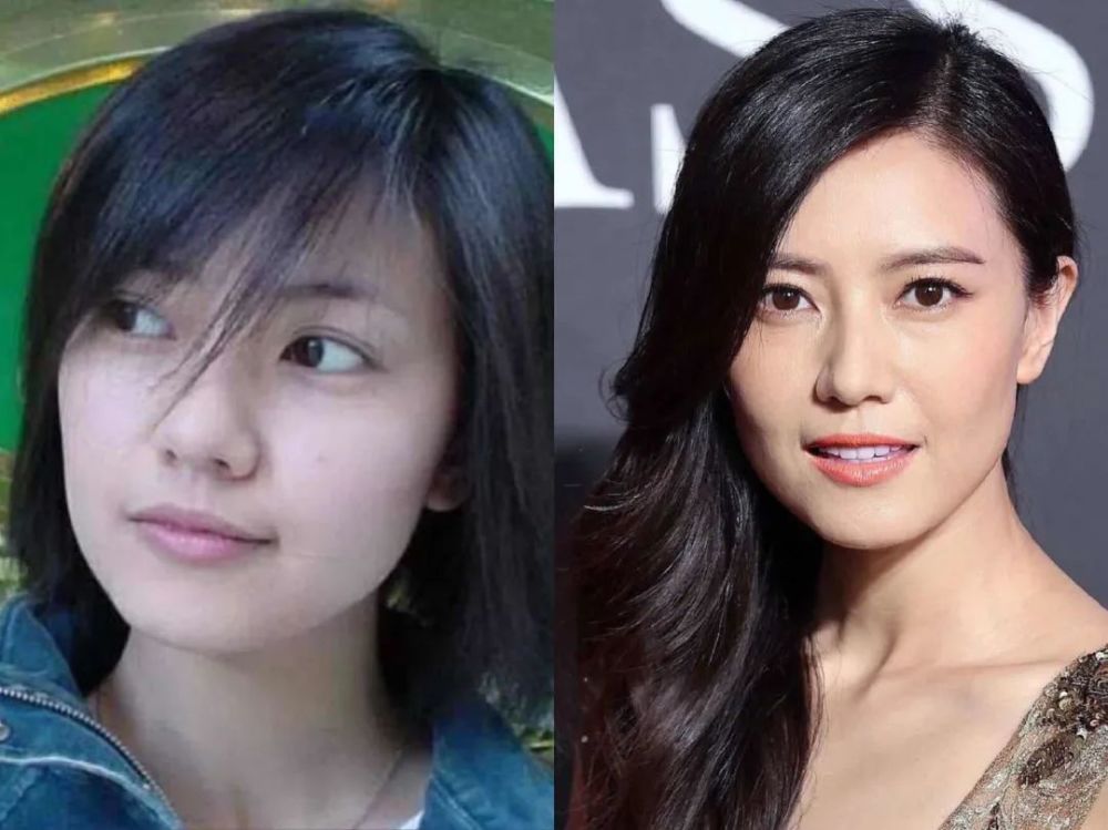 整容|3分到8分，为什么有人是天生适合整容脸？