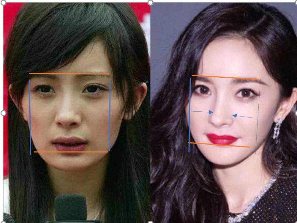 整容|3分到8分，为什么有人是天生适合整容脸？