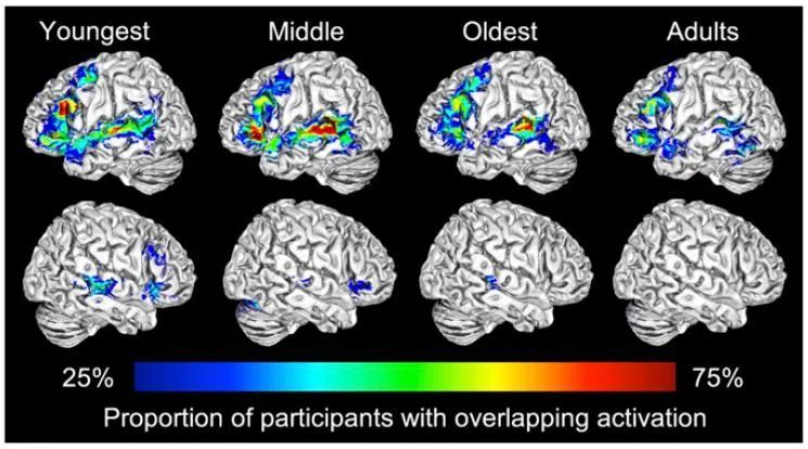 大脑半球|PNAS：与成年人不同，儿童使用两个大脑半球来理解执行语言功能