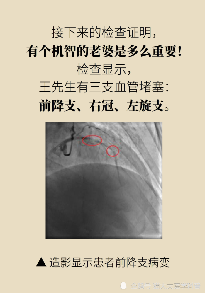 九成|年轻人猝死九成原因是它？想活命，跟老婆做好“五个约定”