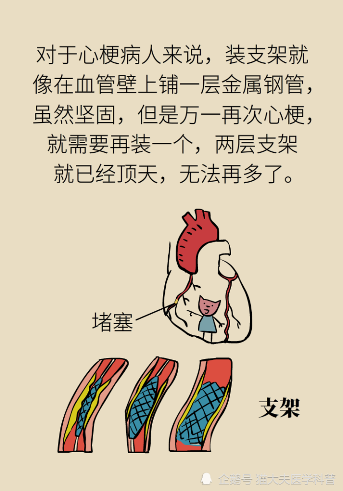 九成|年轻人猝死九成原因是它？想活命，跟老婆做好“五个约定”