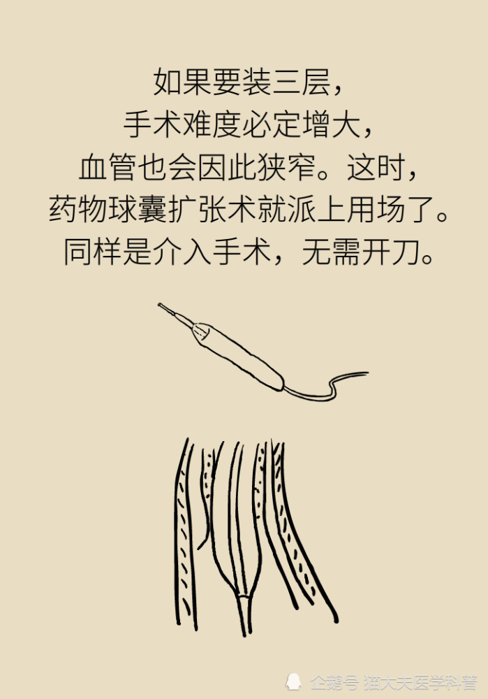 九成|年轻人猝死九成原因是它？想活命，跟老婆做好“五个约定”